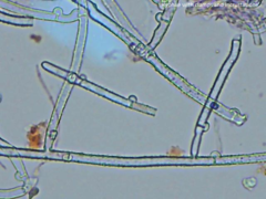Leptosporomyces