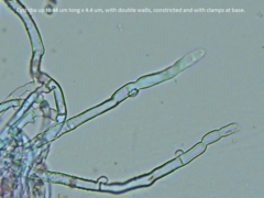 Leptosporomyces