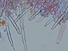 Leptosporomyces