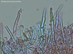 Leptosporomyces