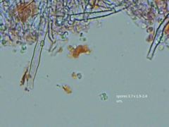 Leptosporomyces