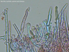 Leptosporomyces