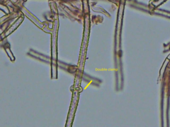 Leptosporomyces