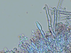 Leptosporomyces