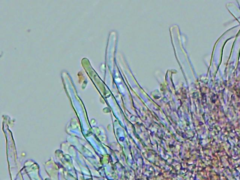 Leptosporomyces