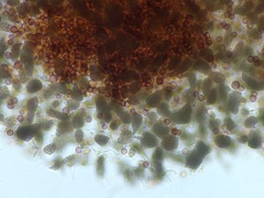 Physarum globuliferum