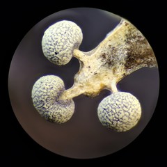 Physarum globuliferum