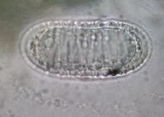 Pertusaria xanthodes