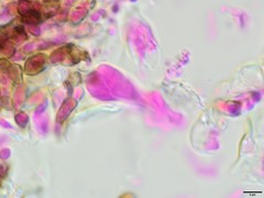 Tremella phaeophysciae