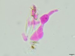 Tremella phaeophysciae