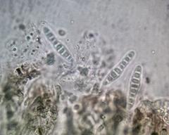 Dimidiographa longissima