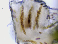 Hysterium angustatum