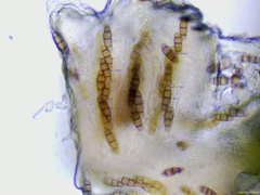 Hysterium angustatum