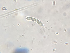 Ophiocytium