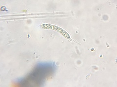 Ophiocytium
