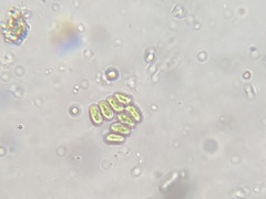 Comasiella