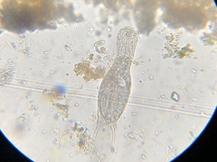Chaetonotidae