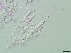 Biatoropsis usnearum