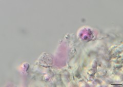 Biatoropsis usnearum