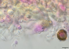 Biatoropsis usnearum