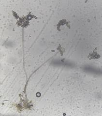 Rhopalomyces elegans