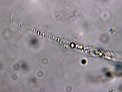 Anthostomella tomicoides
