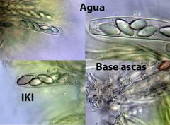 Ascobolus crenulatus