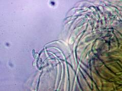 Ascobolus crenulatus