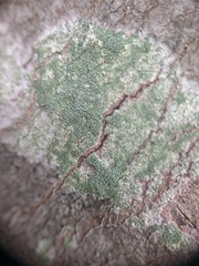 Lecanora confusa