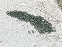 Podospora collapsa