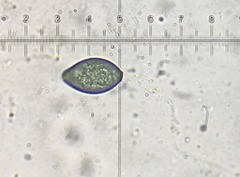 Podospora collapsa