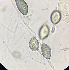Podospora collapsa