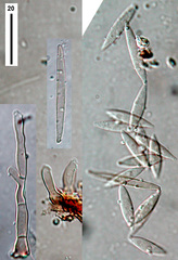 Subramaniomyces fusisaprophyticus