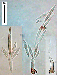 Subramaniomyces fusisaprophyticus