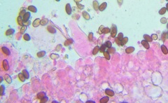 Psathyrella spadiceogrisea