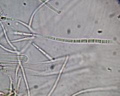 Bactrospora myriadea