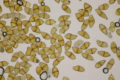 Puccinia liliacearum