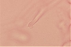 Arthrobotrys