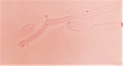 Arthrobotrys
