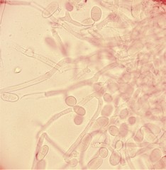 Arthrobotrys