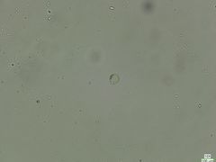 Coscinodiscophycidae