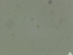 Coscinodiscophycidae