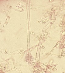 Sphaerostilbella