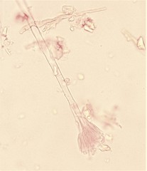 Sphaerostilbella