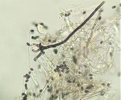 Fungi