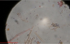 Trichoderma nothescens