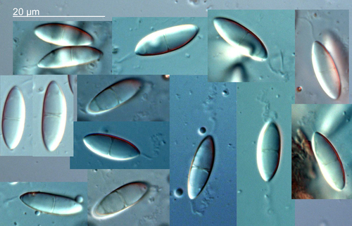 Representative image of Phaeosphaeriaceae