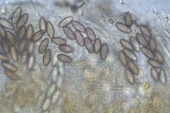 Ascobolus hawaiiensis