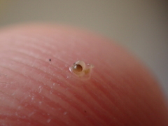 Entoprocta