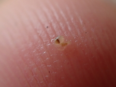 Entoprocta